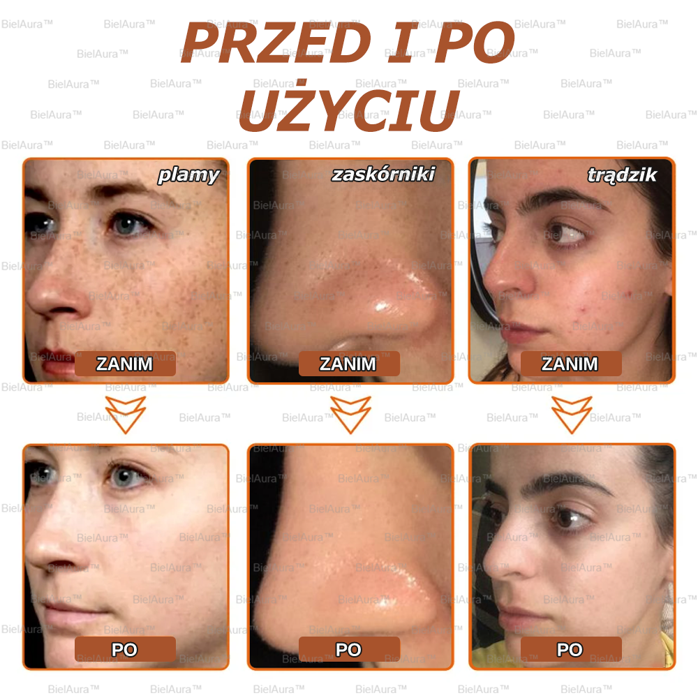 BielAura™ Maska wybielająca i oczyszczająca