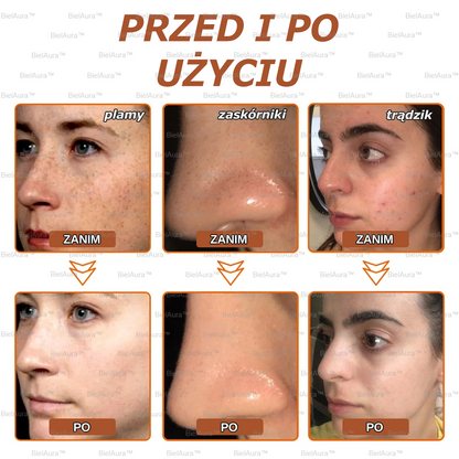 BielAura™ Maska wybielająca i oczyszczająca