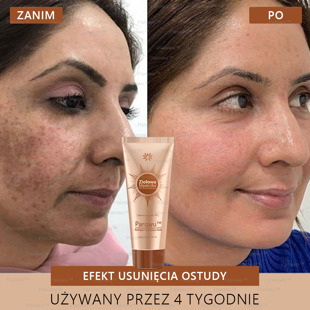 Parowu™ Wybielająca i Rozjaśniająca Maska ✨ Naturalne składniki trwale usuwają plamy, piegi i przebarwienia