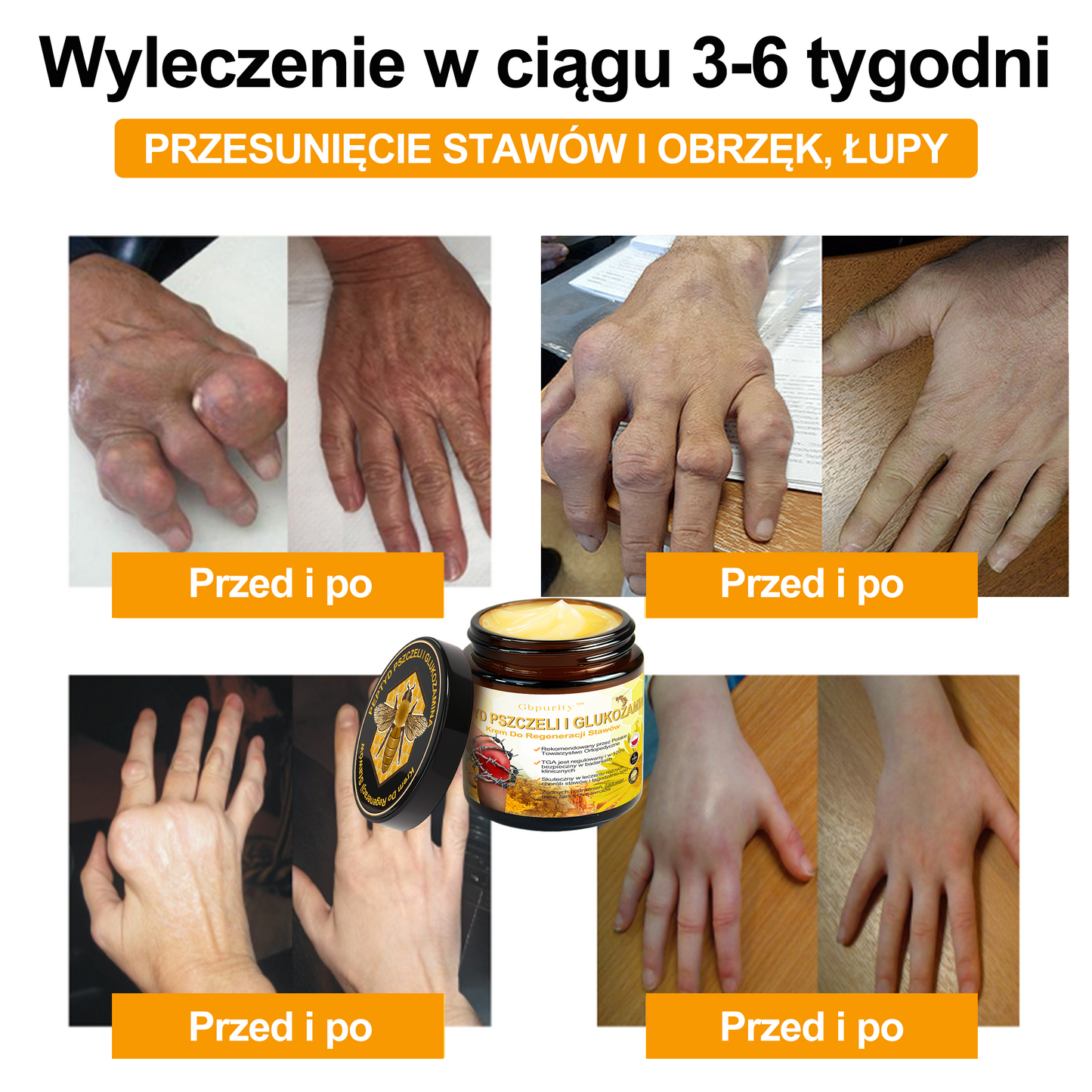 Gbpurity™ Krem Do Regeneracji Stawów | Dla osób w średnim i późnym wieku