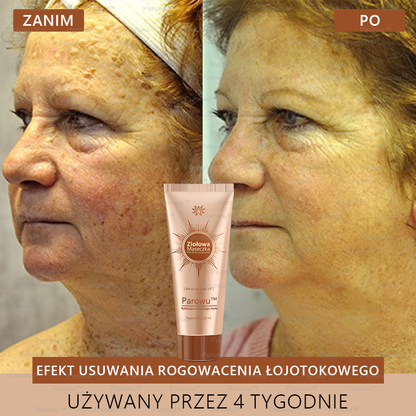 Parowu™ Wybielająca i Rozjaśniająca Maska ✨ Naturalne składniki trwale usuwają plamy, piegi i przebarwienia
