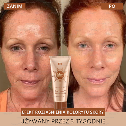 Parowu™ Wybielająca i Rozjaśniająca Maska ✨ Naturalne składniki trwale usuwają plamy, piegi i przebarwienia