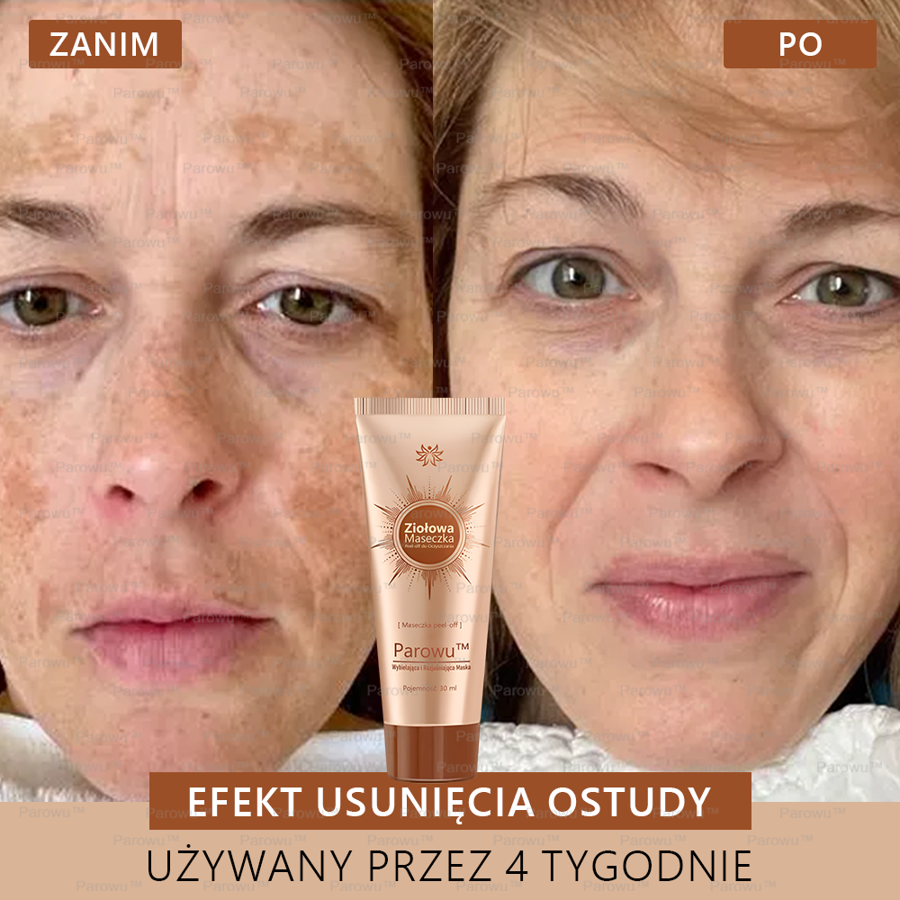 Parowu™ Wybielająca i Rozjaśniająca Maska ✨ Naturalne składniki trwale usuwają plamy, piegi i przebarwienia
