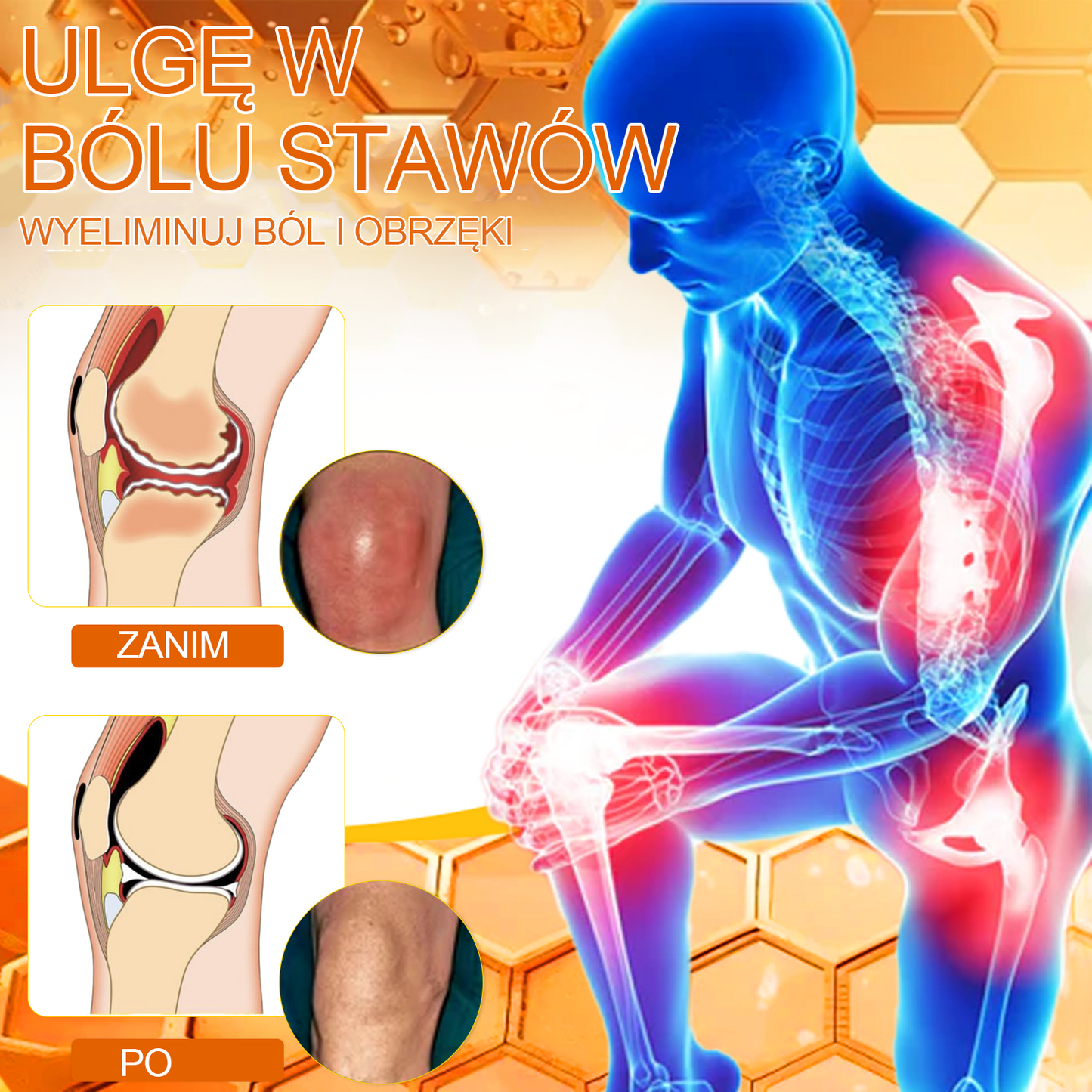 Gbpurity™ Krem Do Regeneracji Stawów | Dla osób w średnim i późnym wieku